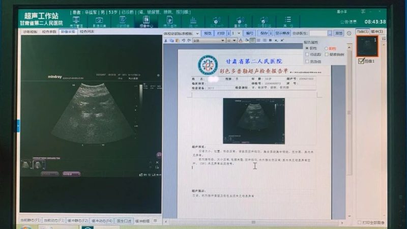 基因检测试剂盒的质量直接影响到检测结果。在采购时，应关注以下质量标准：
